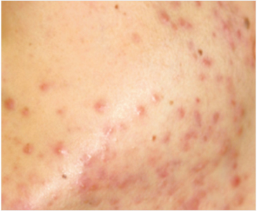 img_product_beforeafter_0101-1 img_product_beforeafter_0101-1