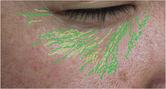 img_product_beforeafter_0301-1 img_product_beforeafter_0301-1