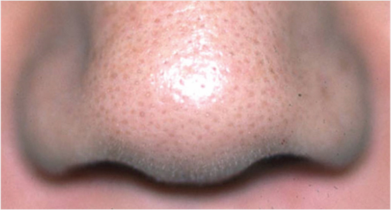 img_product_beforeafter_0401 (1) img_product_beforeafter_0401 (1)