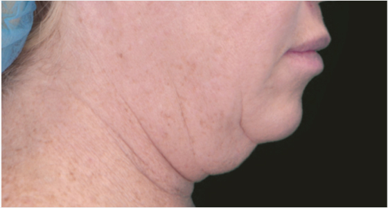 img_product_beforeafter_0501 (1) img_product_beforeafter_0501 (1)