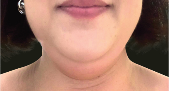 img_product_beforeafter_0601 (1) img_product_beforeafter_0601 (1)